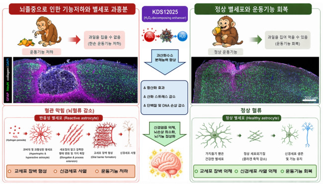 뇌졸중 기능저하와 KDS12025 투여 이후 정상 회복